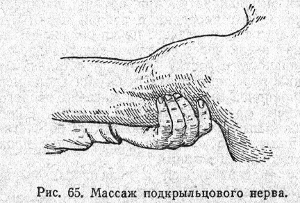 Массаж подкрыльцового нерва